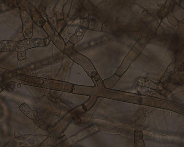 Fotografije Rhizoctonia sp. pod mikroskopom 2